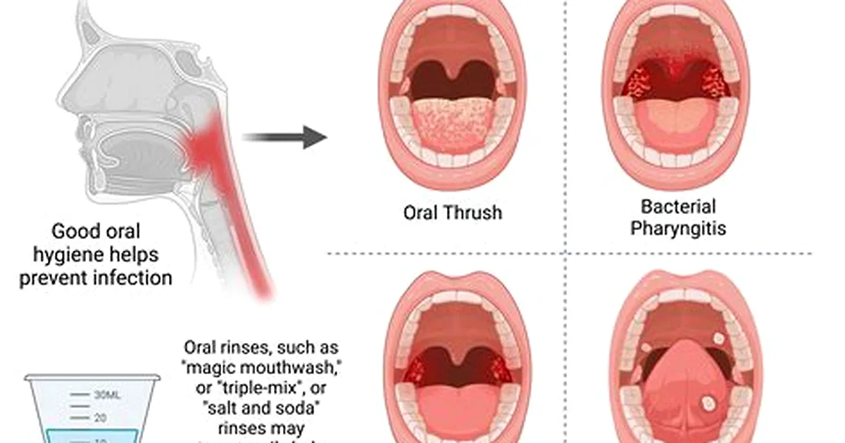 Person holding their throat, illustrating whether Tylenol helps with a sore throat